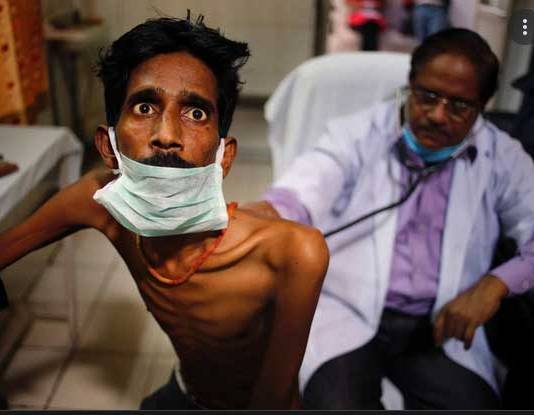 WHO Says 10.6 Million People Infected With Tuberculosis in 2021